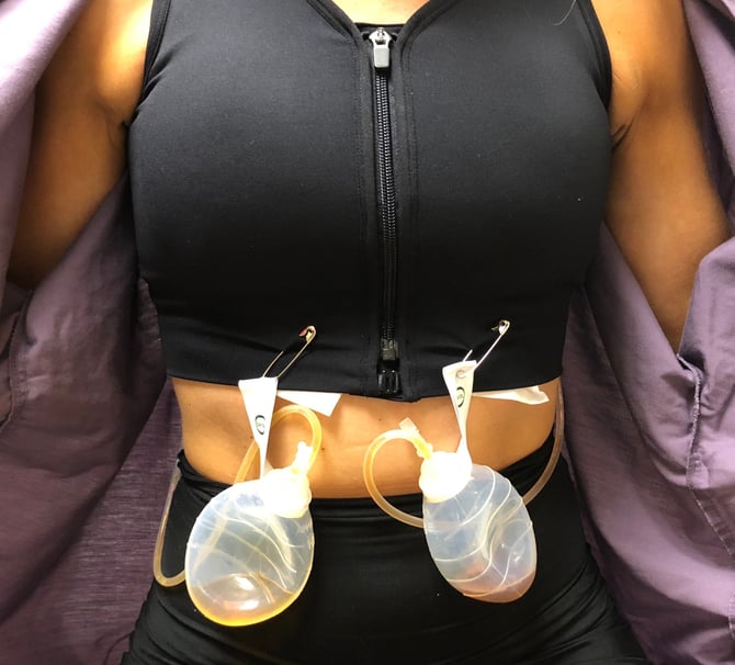 HuggerPRIMA - Post Surgical Drain Management